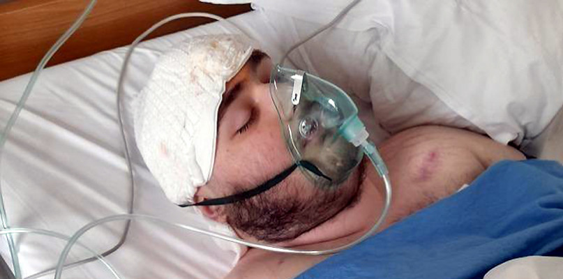 Michała czeka 17. operacja. Pomóżmy!