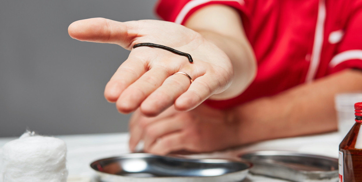 Jakie są przyczyny i objawy migreny? Leczenie migreny pijawkami