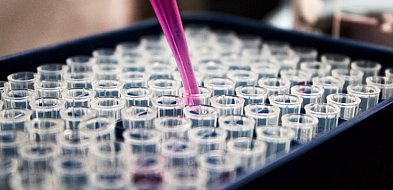 Sprzęt laboratoryjny dla placówek medycznych - dlaczego warto wybierać dostawców..