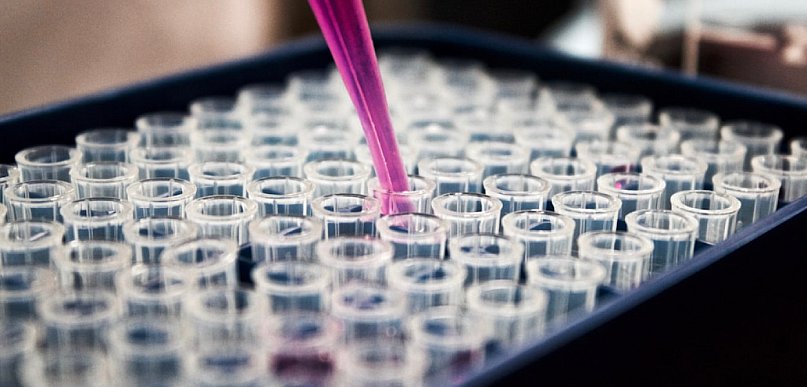 Sprzęt laboratoryjny dla placówek medycznych - dlaczego warto wybierać dostawców..