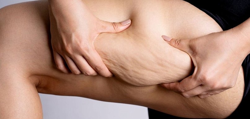 Na czym polega liposukcja ultradźwiękowa i czym różni się od klasycznej